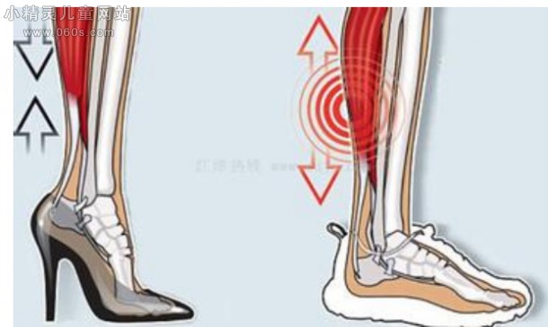 穿高跟鞋 如何防止腿部肌肉萎缩